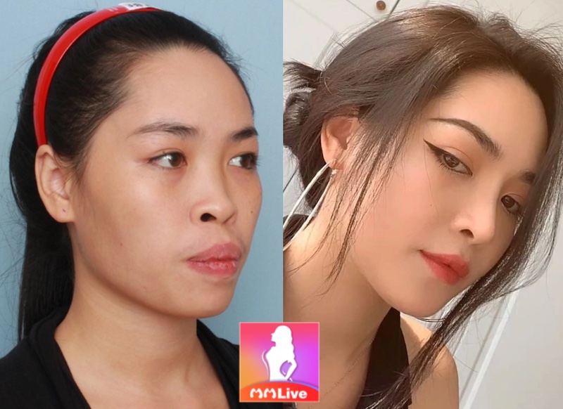 Vũ Thanh Quỳnh - Cuộc đời được “cứu rỗi” nhờ dao kéo quá thành công 2 Vũ Thanh Quỳnh